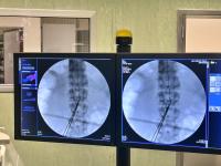 Implementa pela ULS Médio Tejo neuroestimulação para tratamento da dor crónica 